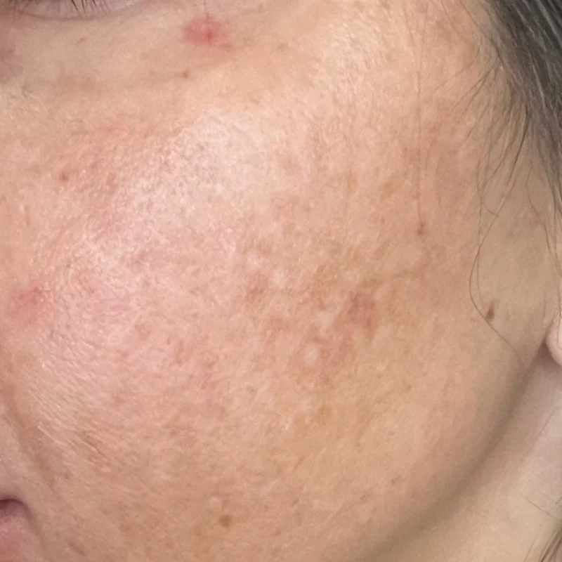 Hydrinity VIVID Brightening Serum