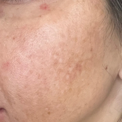 Hydrinity VIVID Brightening Serum