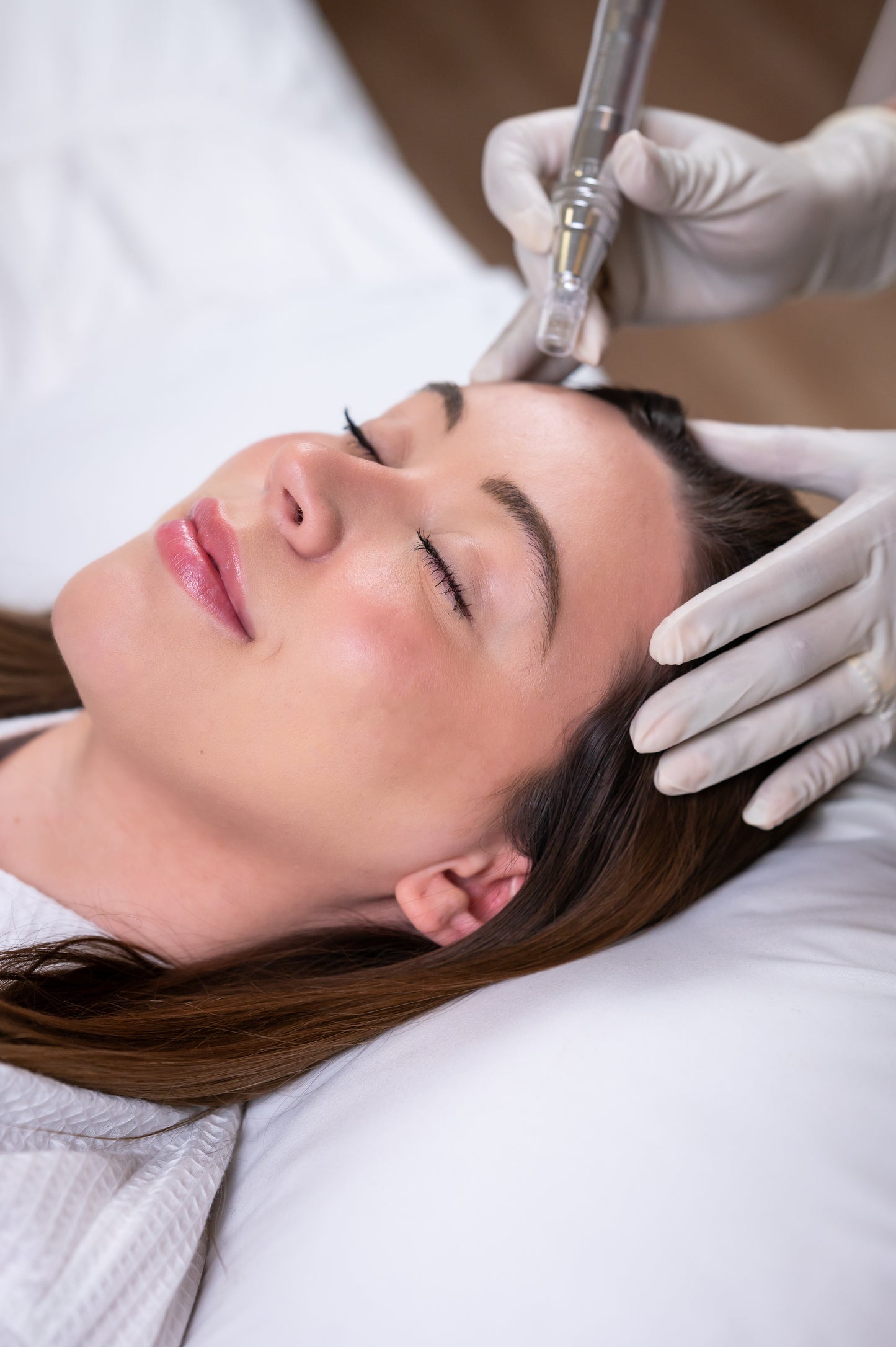 Microneedling Service